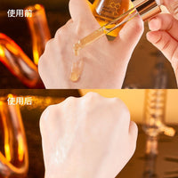 Thumbnail for Soothbosin Polypeptide Sol Anti-Wrinkle Filler: Your Ultimate Solution for Youthful, Radiant Skin!