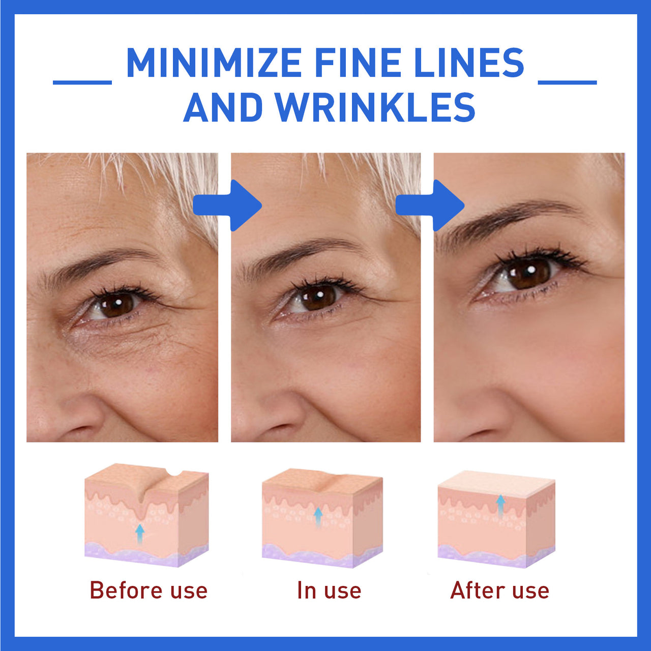 Botox Anti-Wrinkle Serum: Age-Defying Elegance in a Bottle