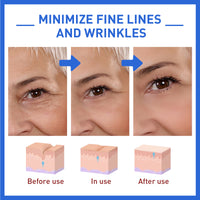 Thumbnail for Botox Anti-Wrinkle Serum: Age-Defying Elegance in a Bottle